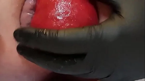 Contender For Biggest Prolapse (Male Warning!)